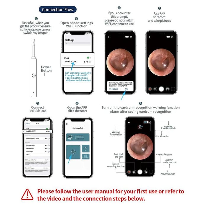 Smart Visual Ear Spoon Tool Set